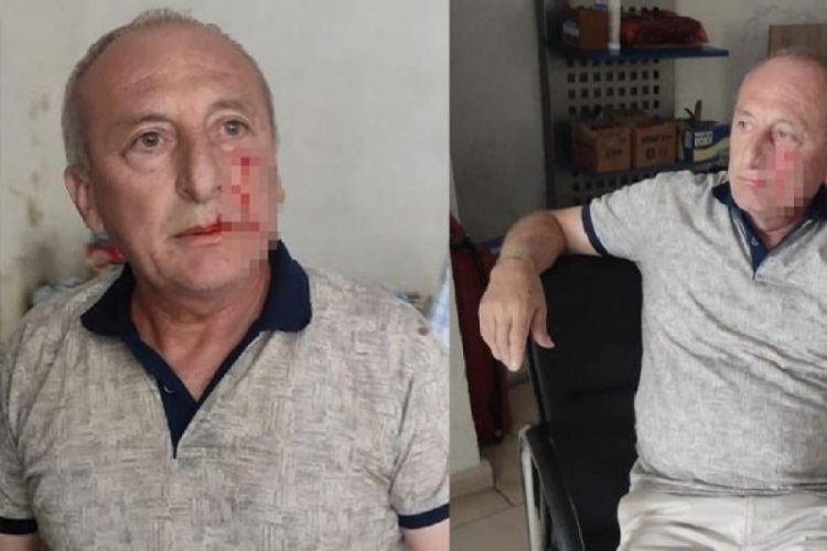 Saldırıya uğrayan Belediye Başkanı'ndan a&ccedil;ıklama