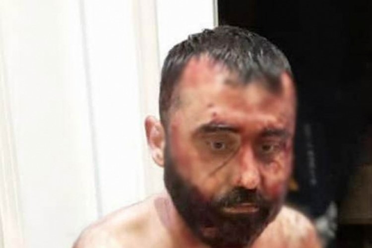 Eski eşi ile 10 g&uuml;nl&uuml;k eşini fal&ccedil;atayla yaralayan eski kocaya 40 yıla kadar hapis istemi