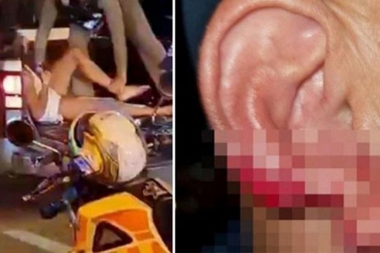 55 yaşındaki adamın kulağını koparıp midesine indirdi