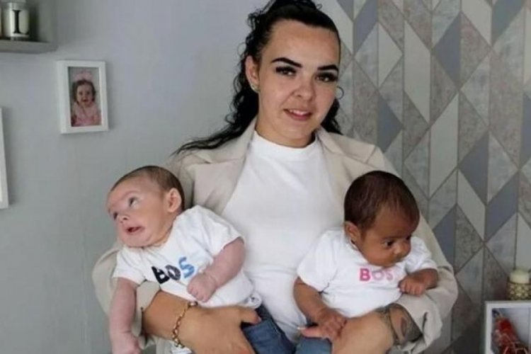 Milyonda bir g&ouml;r&uuml;l&uuml;yor! İkizleri farklı renkle doğdu
