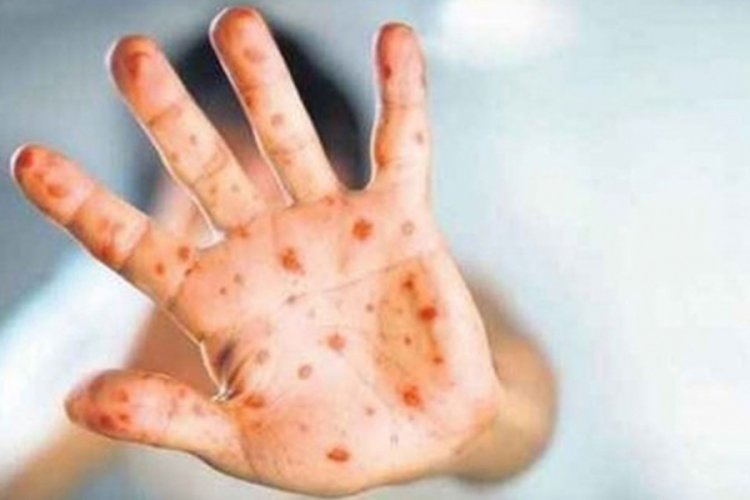 Korkutan uyarı geldi: Domates vir&uuml;s&uuml;yle ilgili yeni detay!