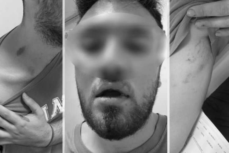 Muğla'da Tıp Fak&uuml;ltesi &ouml;ğrencilerine emlak&ccedil;ıdan darp ve tehdit