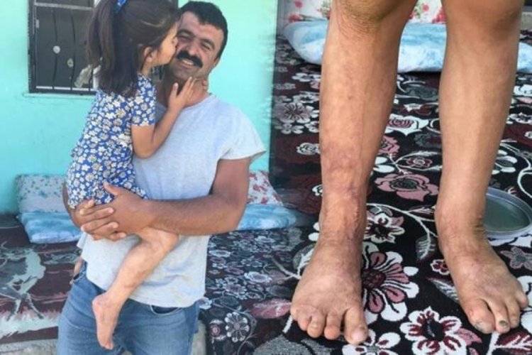 Belden aşağısı tandırda yandı!