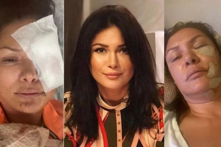 K&ouml;pek saldırısına uğrayan Tuğba Altıntop yaşadıklarını anlattı