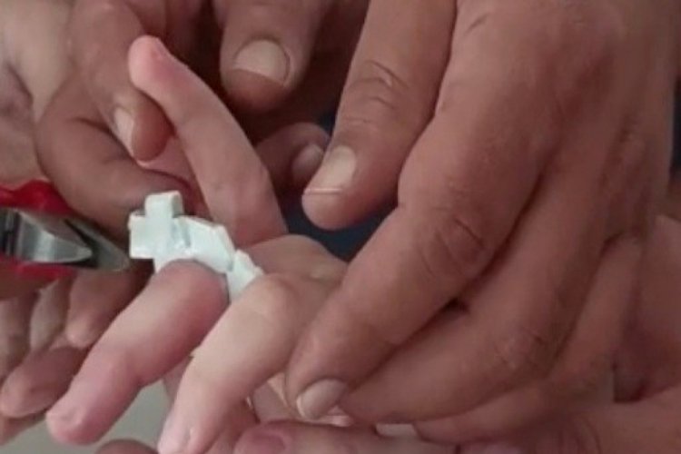 Osmaniye'de &ouml;ğrencinin parmağına plastik par&ccedil;a sıkıştı