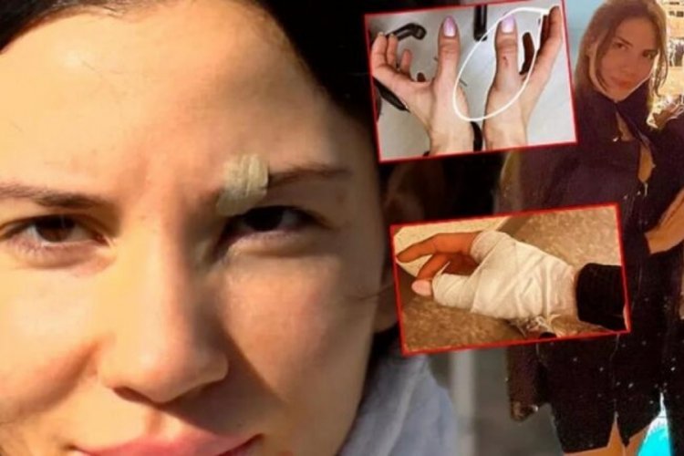 &Ouml;zer Hurmacı ve eşi arasındaki darp davası sonu&ccedil;landı