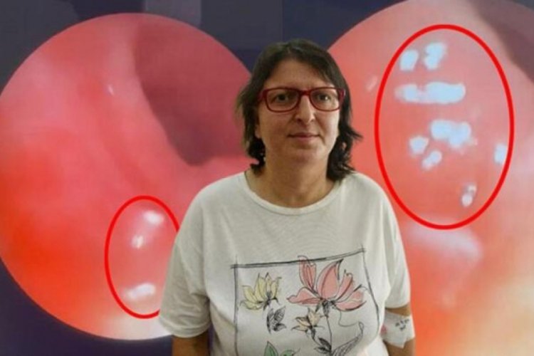 Nefes borusundan canlı sinek larvaları &ccedil;ıktı
