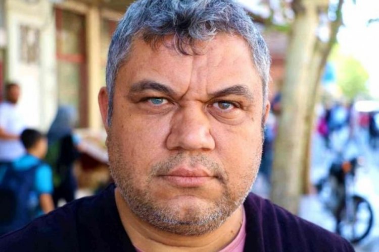 Annesi tarafından yapılan dua sonrası sol g&ouml;z&uuml; mavi, sağ g&ouml;z&uuml; yeşil