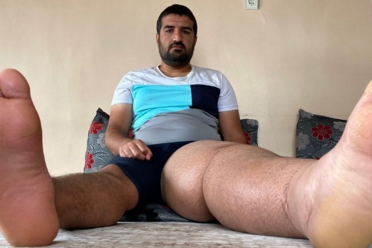 Diyarbakırlı iş&ccedil;inin ge&ccedil;irdiği iş kazasında ayağı şişti