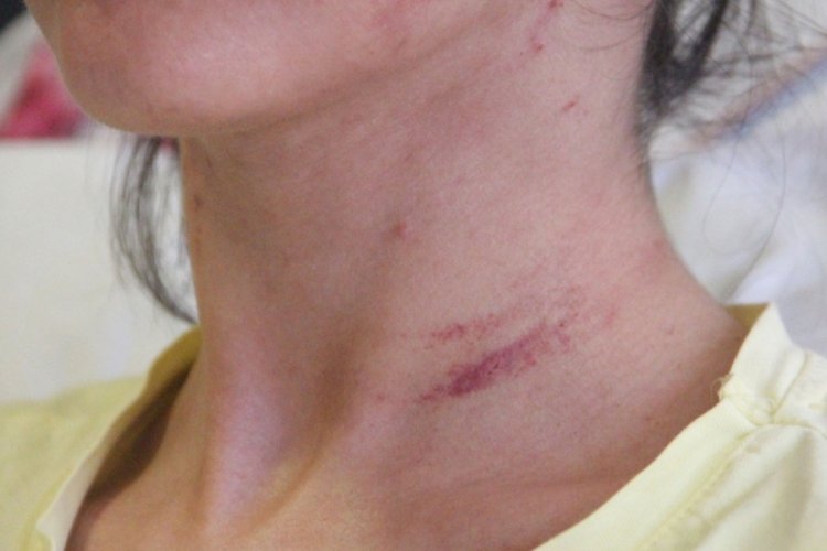 Doktor, sevgilisini 2 saat boyunca darp edip bı&ccedil;aklamıştı! Cezası...