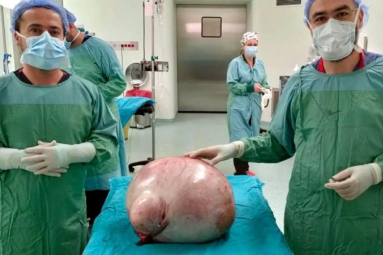 Tekirdağ'da hastanın karnından 35 kiloluk kitle &ccedil;ıkarıldı