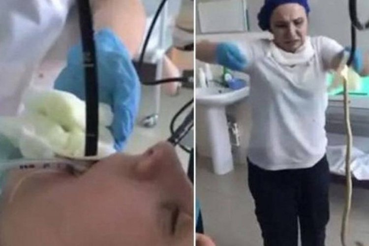 Gen&ccedil; kadının midesinden &ccedil;ıkarılan yılan şoke etmişti! Meğer i&ccedil;eri b&ouml;yle girmiş
