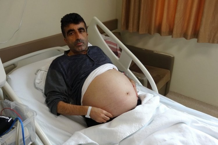 Tokat'ta kendini kilolu sanan adamın karnından 13 kilo kitle &ccedil;ıktı
