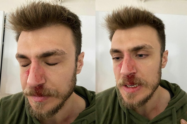 İzmir'de darp doktor kafa travması ge&ccedil;irmiş
