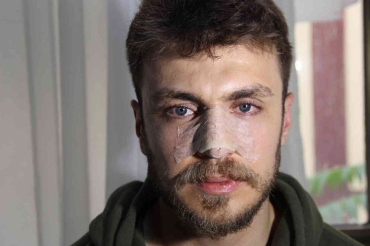 'Erkek doktor eşimi muayene edemez' deyip saldırmıştı: Tutuklandı