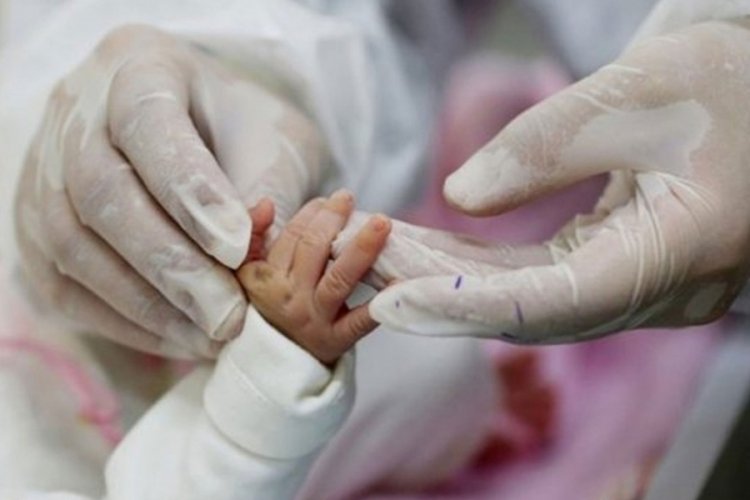 1 milyon &ouml;l&uuml; doğum! Araştırmalardan korkun&ccedil; sonu&ccedil; ortaya &ccedil;ıktı
