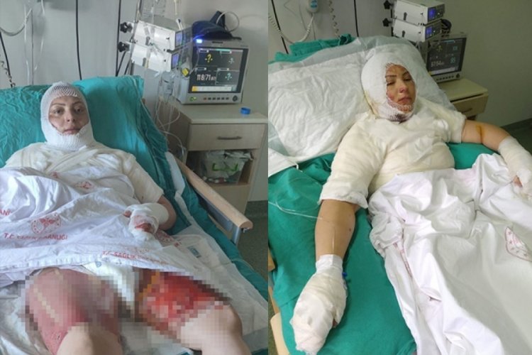Ordu'da eski eşini yakan sanığa 20 yıl hapis istemi