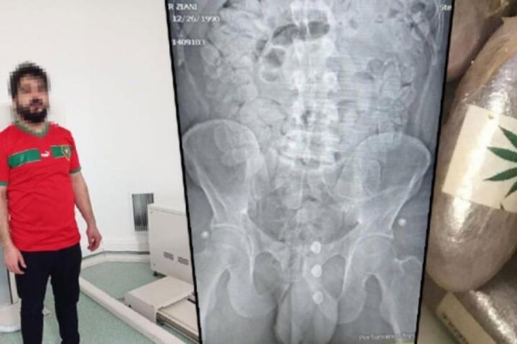 1,5 kilo esrarı kokusu ele verdi