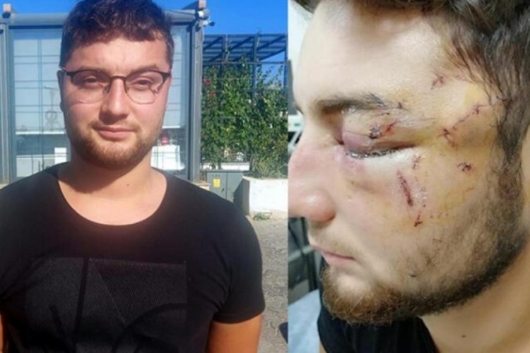 Ayırmaya &ccedil;alıştığı kavgada g&ouml;z&uuml;n&uuml; kaybetti!