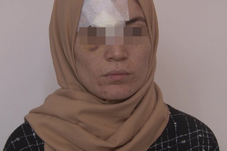 Hatay'da ilişkiye girmediği kocasından dayak yedi