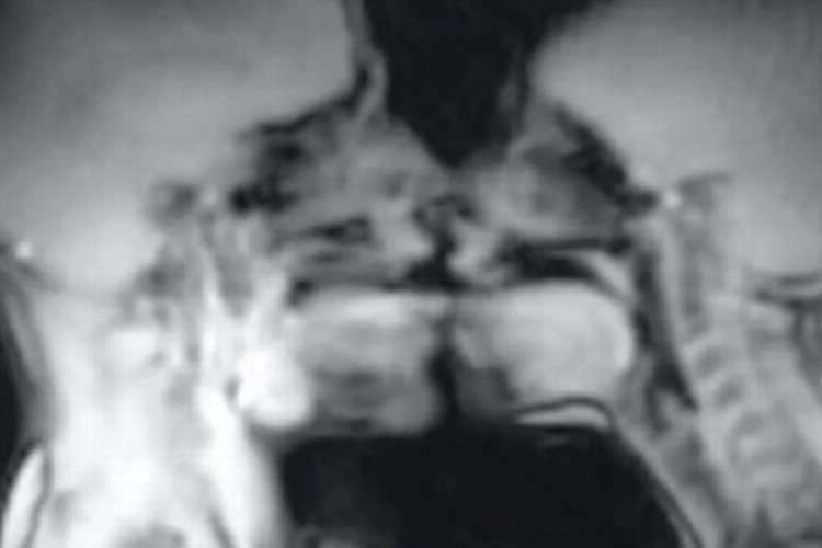 MRI cihazı i&ccedil;inde cinsel ilişki g&ouml;r&uuml;nt&uuml;leri şoke etti