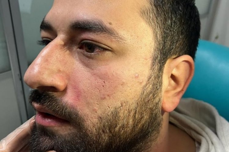 Elazığ'da hem randevuya ge&ccedil; geldi, hem de doktoru darp etti