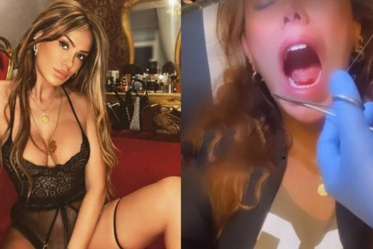 Ceyda Ersoy, &ouml;p&uuml;ş&uuml;rken kopan dilini diktirdi