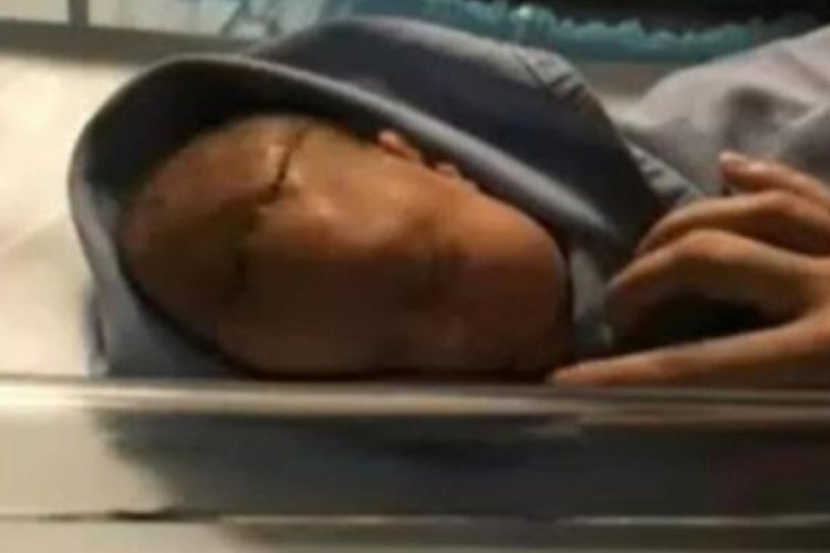 Tekirdağ'da doktor doğumda bebeğin başını kesti!