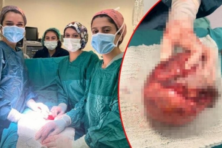Şırnak'ta 18 yaşındaki kızın karnından &ccedil;ıkan şoke etti!