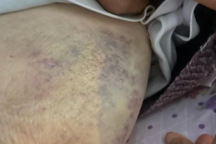 Ankara'da bakıcı dehşeti! Darp edilen yaşlı kadın &ouml;l&uuml;m kalım savaşı veriyor