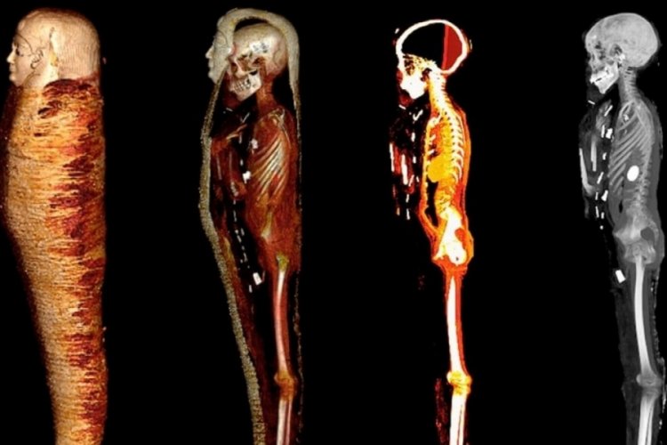 Altın &Ccedil;ocuk mumyası 'a&ccedil;ıldı'