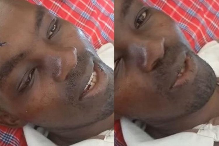 Kenya'da bir kadın eşinin penisini ısırarak koparttı