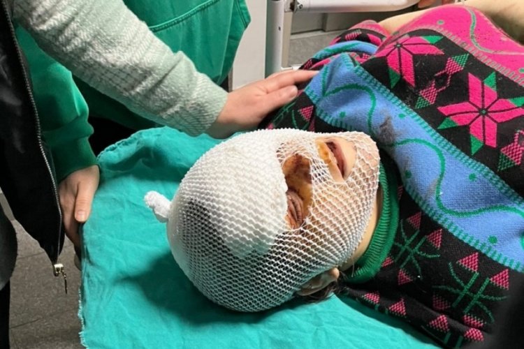 Sakarya'da barışma teklifini reddeden eski dini nikahlı eşinin y&uuml;z&uuml;n&uuml; kesti