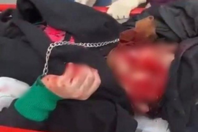 Dini nikahlı eski eşinin saldırısına uğradı! Kanlar i&ccedil;inde kaldı