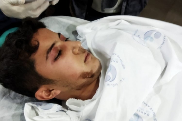 Enkazdan kurtarılan depremzede daha &ouml;nce de beyin t&uuml;m&ouml;r&uuml;nden kurtulmuş
