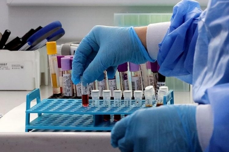 Depremde hayatını kaybeden yakınlarını arayan kişiler i&ccedil;in 'kan &ouml;rneği' &ccedil;ağrısı