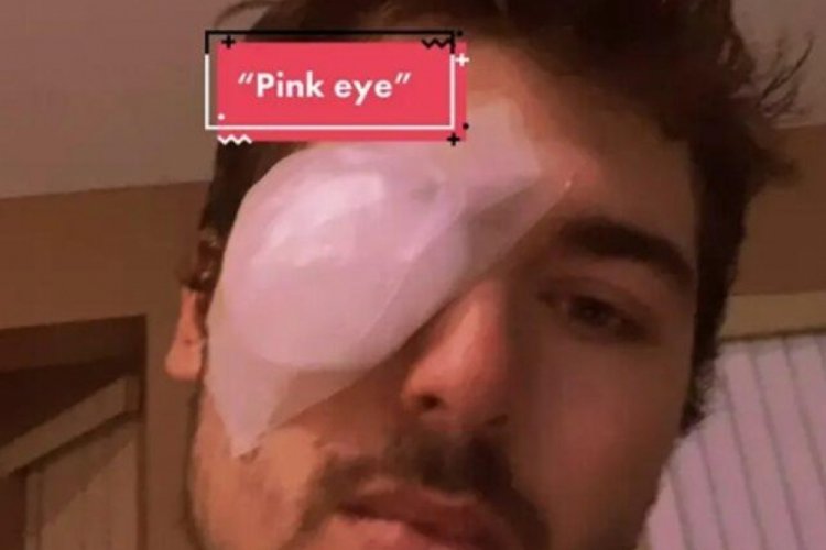 Şekerleme yapmak istedi hayatı karardı!