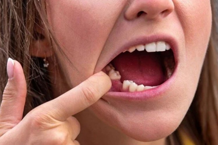 Kadın &ccedil;alışan dişleri nedeniyle ilk iş g&uuml;n&uuml;nde işten kovuldu