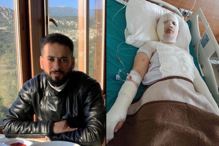 Hatay'da depremden ka&ccedil;tı: Eski eşi kaynar suyla yaktı