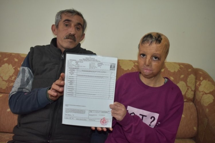 Suriye'deki evine bomba d&uuml;şerek y&uuml;z&uuml; yanan Evin sağlığına kavuşmak istiyor