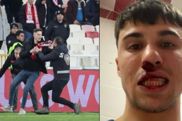 Sivas'ta Bianco'ya saldıran 2 ş&uuml;pheli tutuklandı