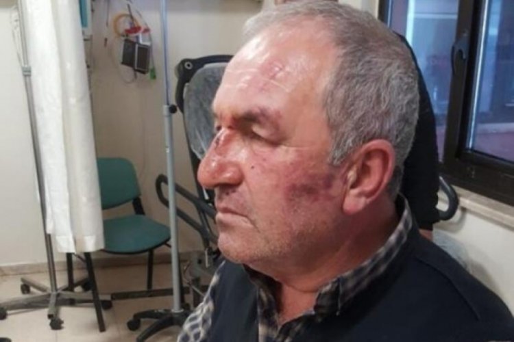 Kulak zarını patlatana kadar d&ouml;vd&uuml;ler!