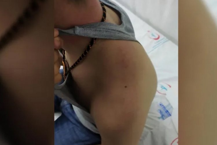 Diyarbakır'da &ccedil;ocuğa darp: Komiser ve d&ouml;rt polis memur g&ouml;revden uzaklaştırıldı