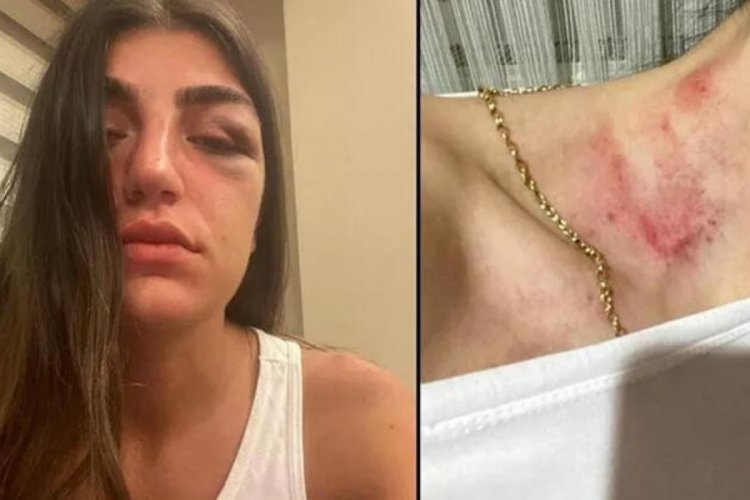 Manken Gizem Akbaş'ı darbeden eski sevgiliye istenen ceza belli oldu