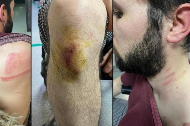 İstanbul'da kiracıya 'evden &ccedil;ık' dayağı!