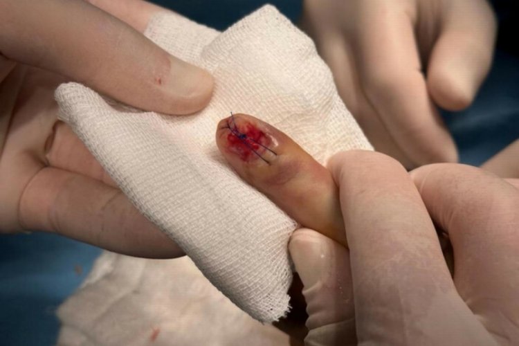 Denizli'de eski eşten kıskan&ccedil;lık ısırığı! 2 yıl hapis istendi