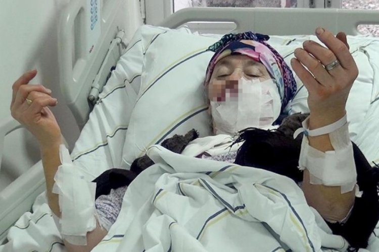 Erzurum'da kurtlar 4 kişi yaraladı: kuduz ş&uuml;phesi ile alarma ge&ccedil;ildi