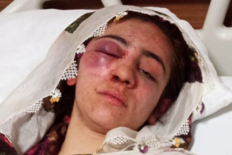 Elazığ'da ka&ccedil;an kız &ouml;ld&uuml;resiye darbedildi