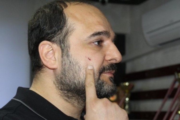 Antalya'da avukat 1 yılda 2'nci kez saldırıya uğradı: Can g&uuml;venliğimiz tehdit altında