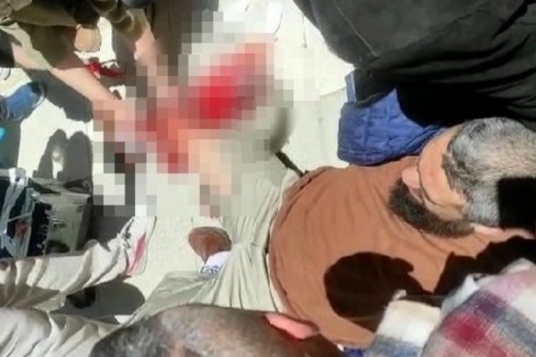 Elazığ'da cadde ortasında bacağından vuruldu: Saldırgan arkasına bakmadan ka&ccedil;tı!